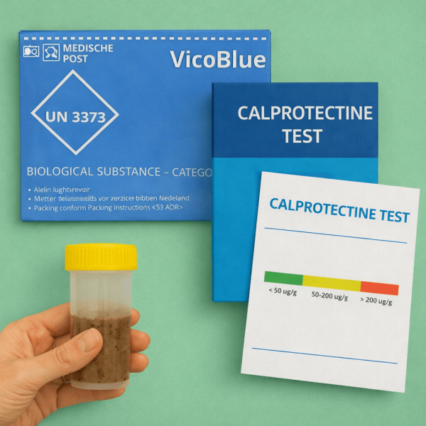 calprotectine test